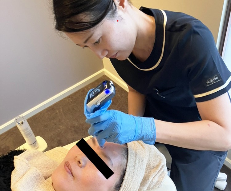 肌が発光した日。看護師木村のヴェルベットスキン体験記